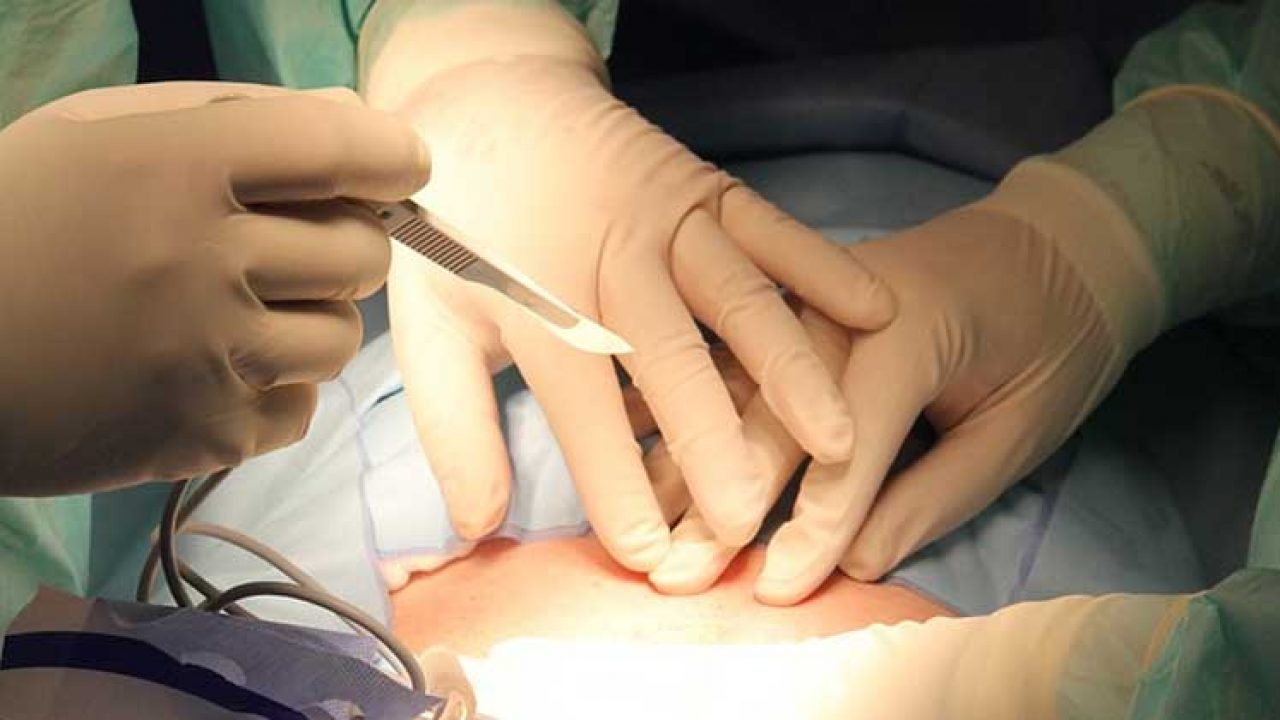 operație pentru restabilirea vederii după naștere