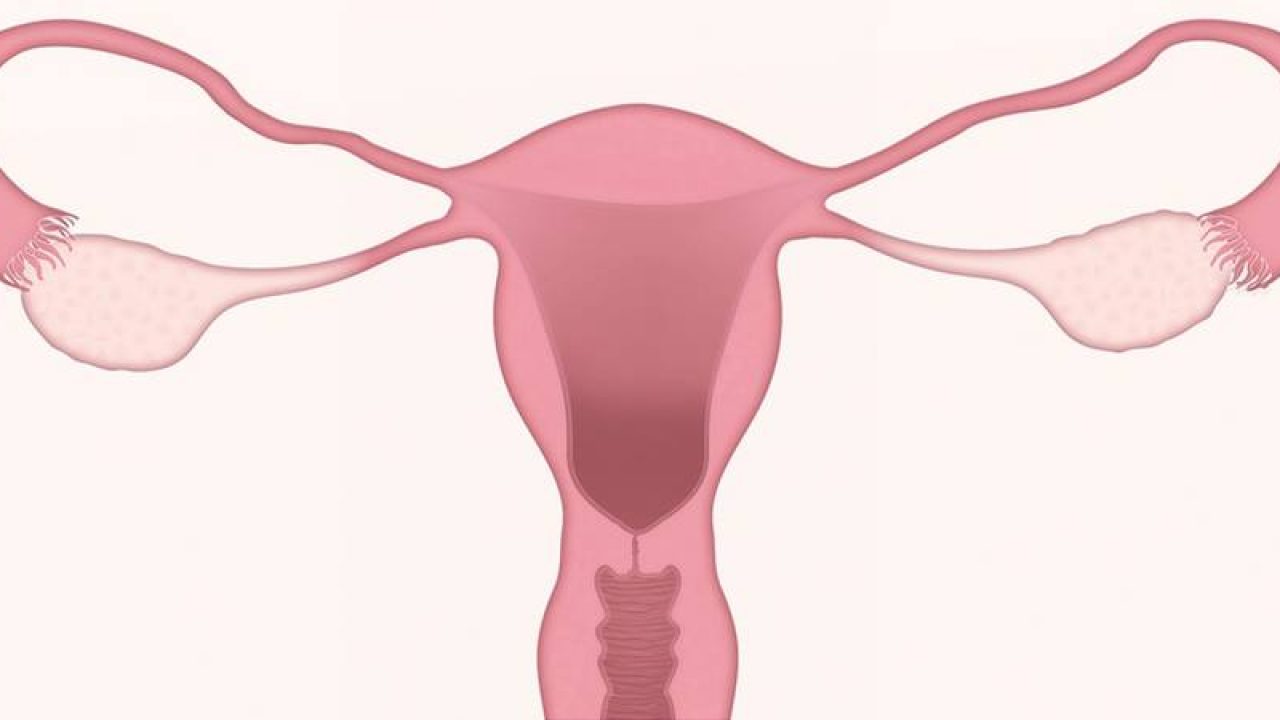 poate polipii uterine provoacă pierderea în greutate