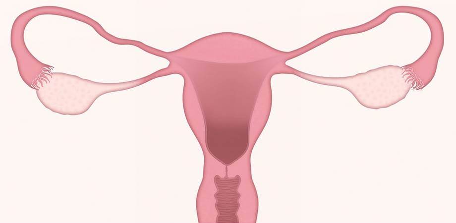 legarea trompelor uterine