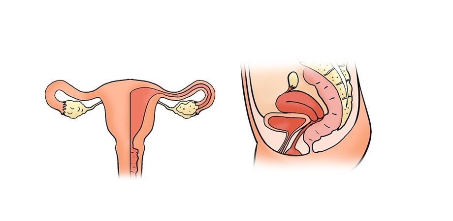 diagnostic torsiune ovariana